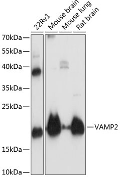 VAMP2 Antibody