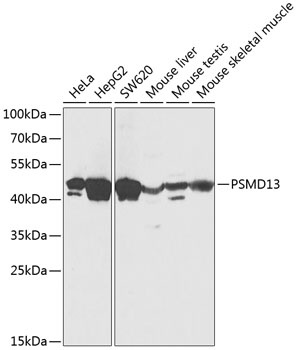 PSMD13 Antibody