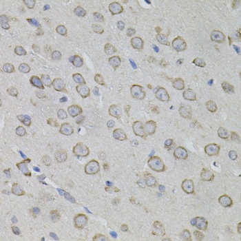 MYO10 Antibody