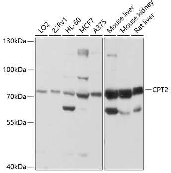 CPT2 Antibody