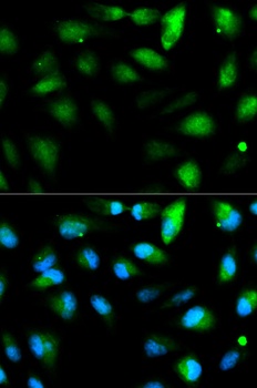 F11R Antibody
