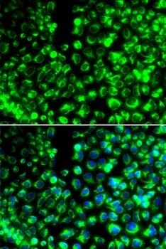 CALU Antibody
