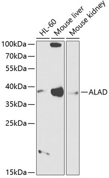 ALAD Antibody