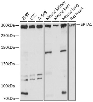 SPTA1 Antibody