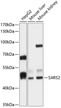 SARS2 Antibody