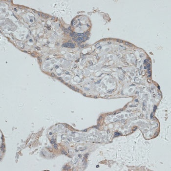 GMPR Antibody