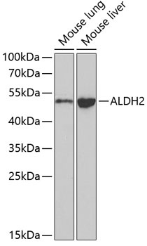 ALDH2 Antibody