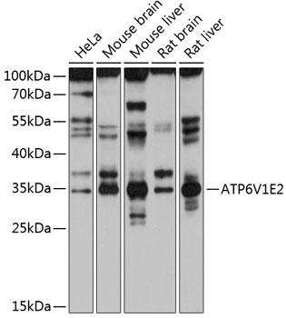 ATP6V1E2 Antibody