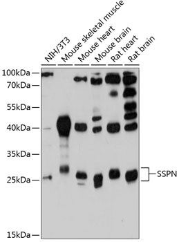 SSPN Antibody