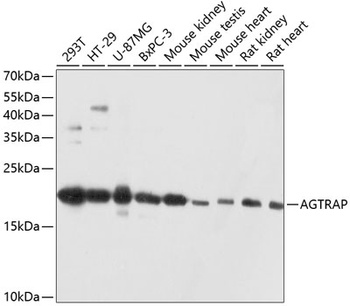 AGTRAP Antibody