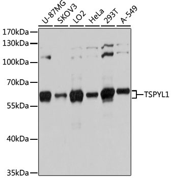 TSPYL1 Antibody