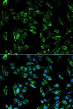 TPM3 Antibody
