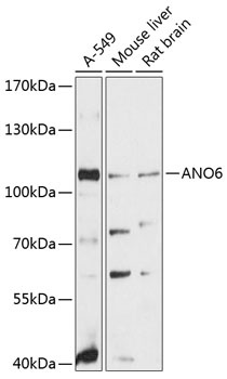 ANO6 Antibody