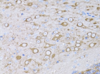 MYH10 Antibody