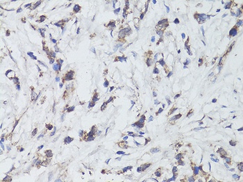 NTRK2 Antibody