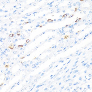 FGF10 Antibody