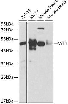 WT1 Antibody