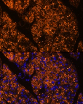 SERPINI2 Antibody
