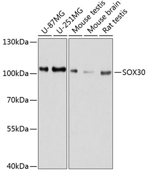 SOX30 Antibody