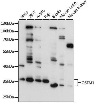 OSTM1 Antibody