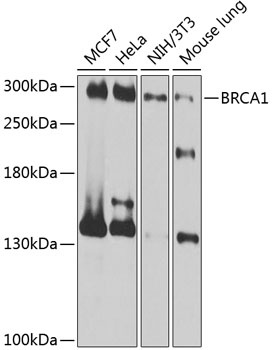 BRCA1 Antibody