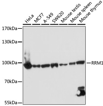 RRM1 Antibody