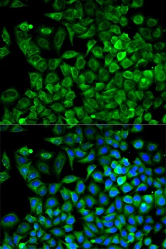 ALDOA Antibody