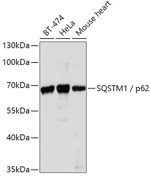SQSTM1 / p62 Antibody