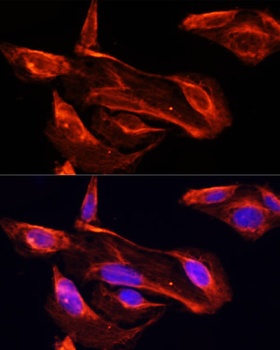 MMP2 Antibody