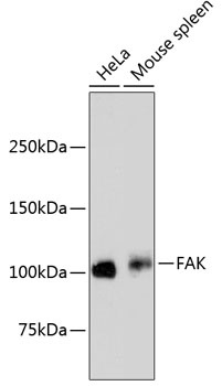 FAK Antibody [E1E5]