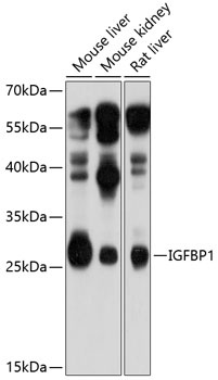 IGFBP1 Antibody