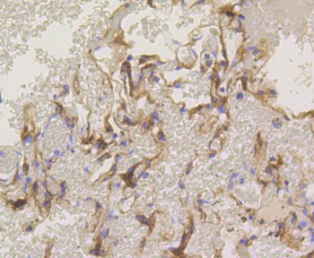 PRKCA Antibody