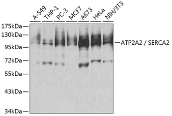 ATP2A2 Antibody