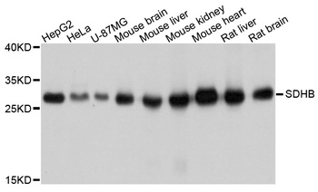 SDHB Antibody