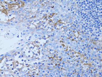 HADH Antibody