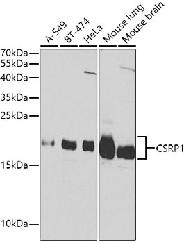 CSRP1 Antibody