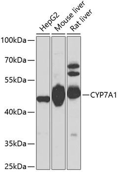 CYP7A1 Antibody