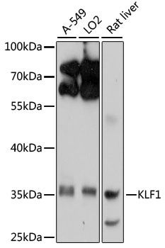 KLF1 Antibody