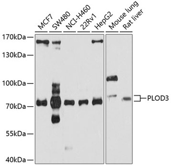 PLOD3 Antibody