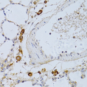 PHGDH Antibody