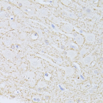PHGDH Antibody