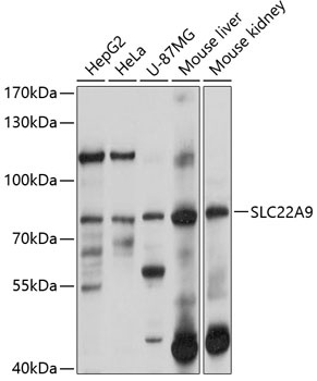 SLC22A9 Antibody