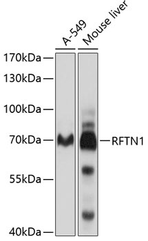 RFTN1 Antibody