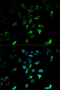 STAR Antibody