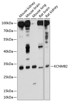 KCNMB2 Antibody