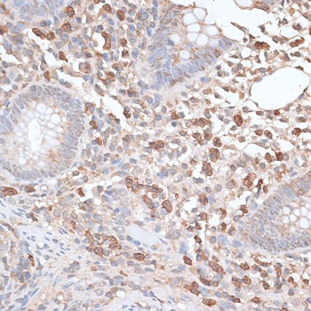 KCNMB2 Antibody