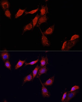 GPER1 Antibody