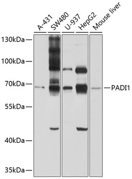 PADI1 Antibody