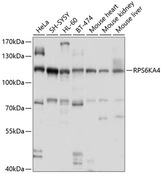 RPS6KA4 Antibody