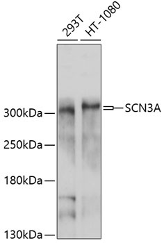SCN3A Antibody